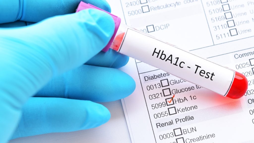 HbA1c Blood Test on Diabetes