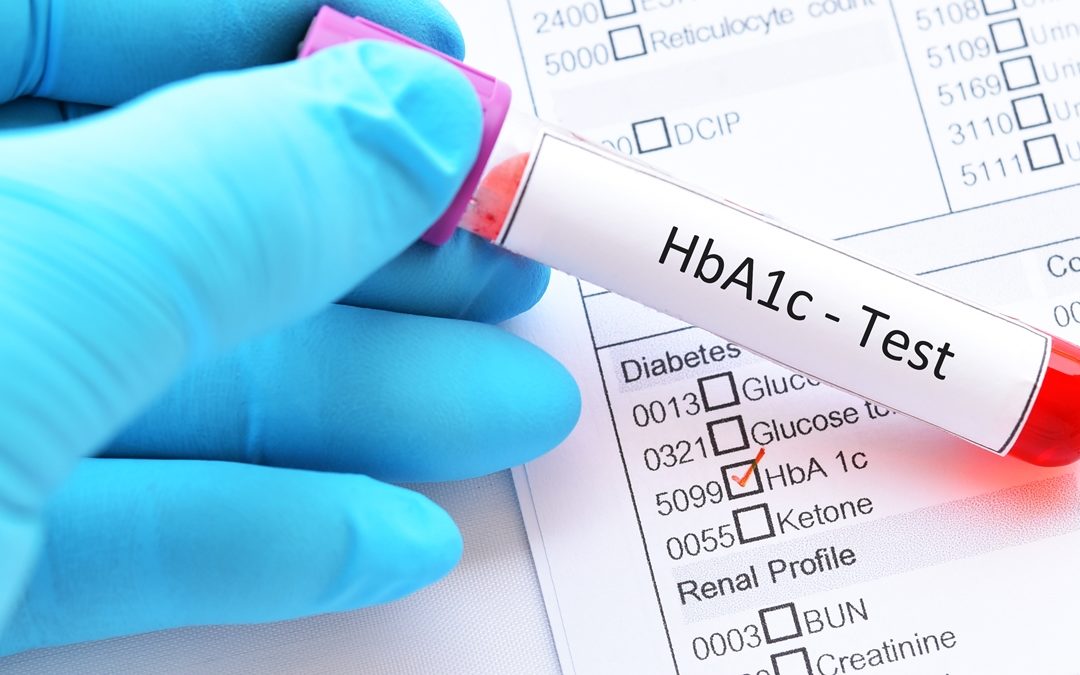 HbA1c (Hemoglobin A1C) Blood Test And Its Impact On