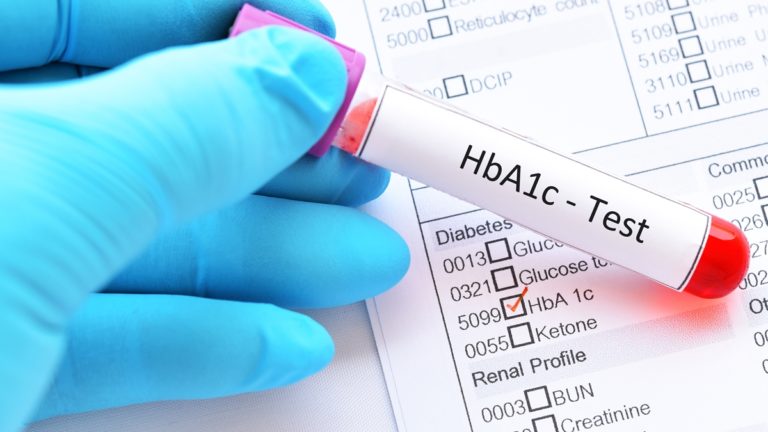 HbA1c (Hemoglobin A1C) Blood Test and Its Impact on Diabetes