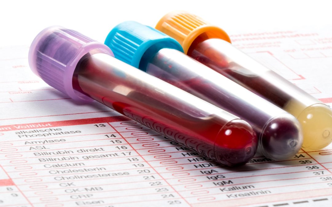 A Beginner’s Guide To Blood Tests