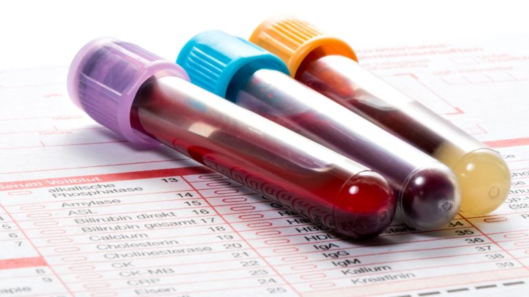 A Beginner’s Guide To Blood Tests